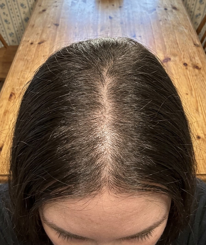 Day 1